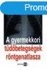 A GYERMEKKORI TDBETEGSGEK RNTGENATLASZA