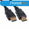BLACKBIRD Kbel HDMI male/male sszekt 2K 1m, Fekete