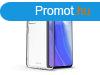 ROAR All Day Full 360 - transparent Xiaomi Mi 10T/Mi 10T Pro