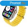 Ultra watch srga - Emeld ki stlusodat ezzel az egyedlll