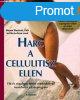 Harc a cellulitisz ellen - Wayne-Loud Westcott; La Rosa